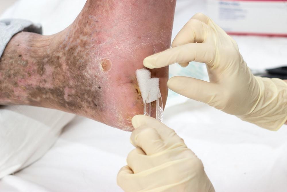 Law firm handling cases involving infections and abuse of nursing home residents.
 