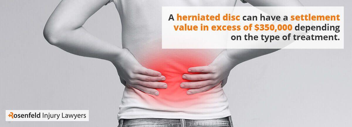 A herniated disc can have a settlement value in excess of 0,000 depending on the type of treatment.