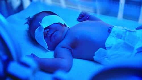 newborn jaundice birth injury lawsuit