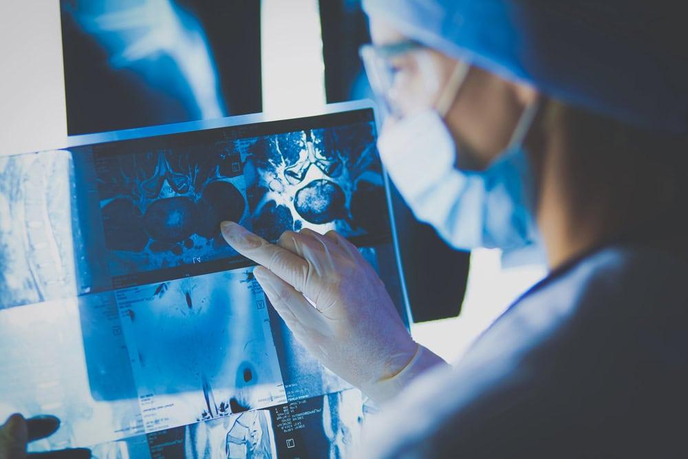 Rockford cancer misdiagnosis lawyer reviewing a medical malpractice claim with a client.
 