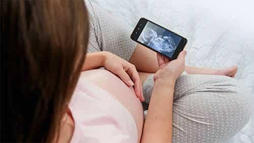 neonatal stroke birth injury lawsuit