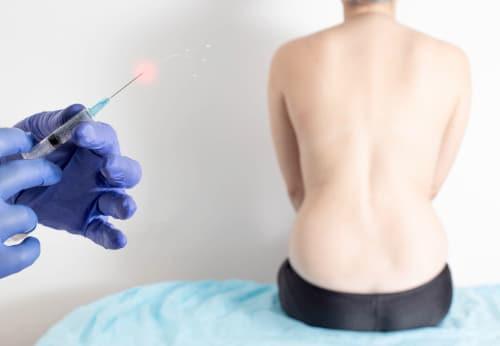 Epidural steroid injections and personal injury settlements