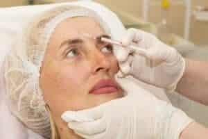 Chicago Plastic Surgery Lawyer