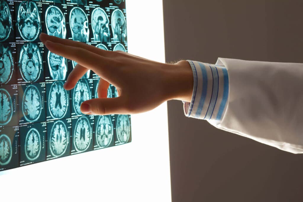 Brain Injuries