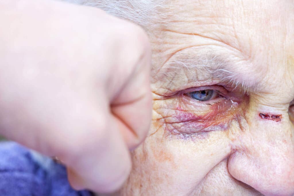 Elder Abuse Lawyer