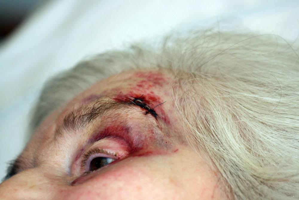 Attorney in Chicago reviewing a physical abuse case in a nursing facility