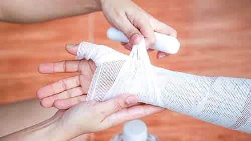 statistics-burn-injury-accidents