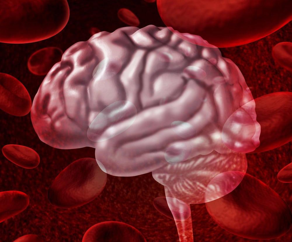 Damaged brain tissue from a traumatic brain injury.