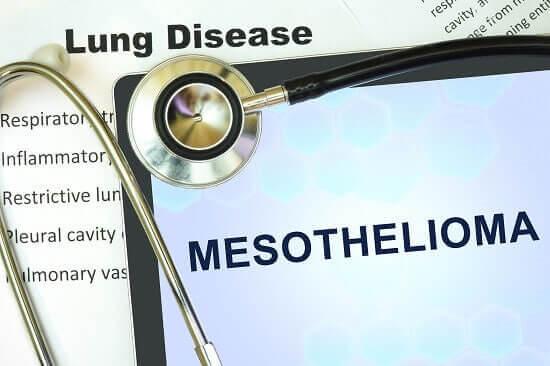 mesothelioma lawyer