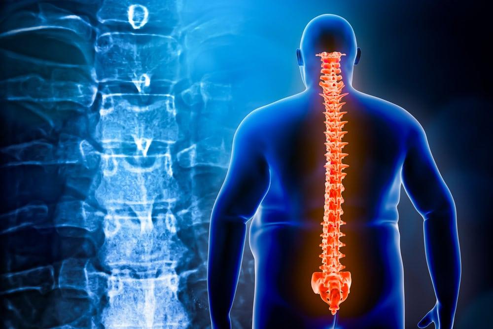 Chicago attorney specializing in car accident herniated disc cases.