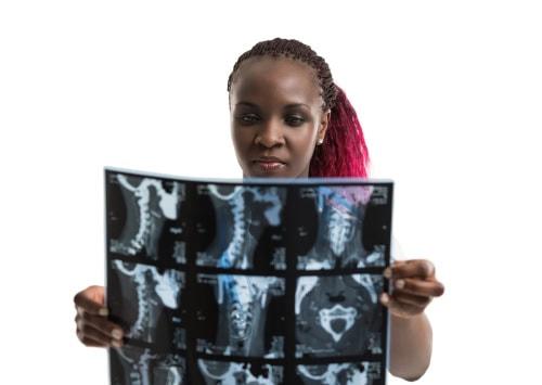 What Whiplash Might Look Like on an MRI
