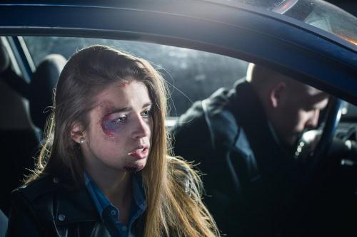 Passenger injury in car accident