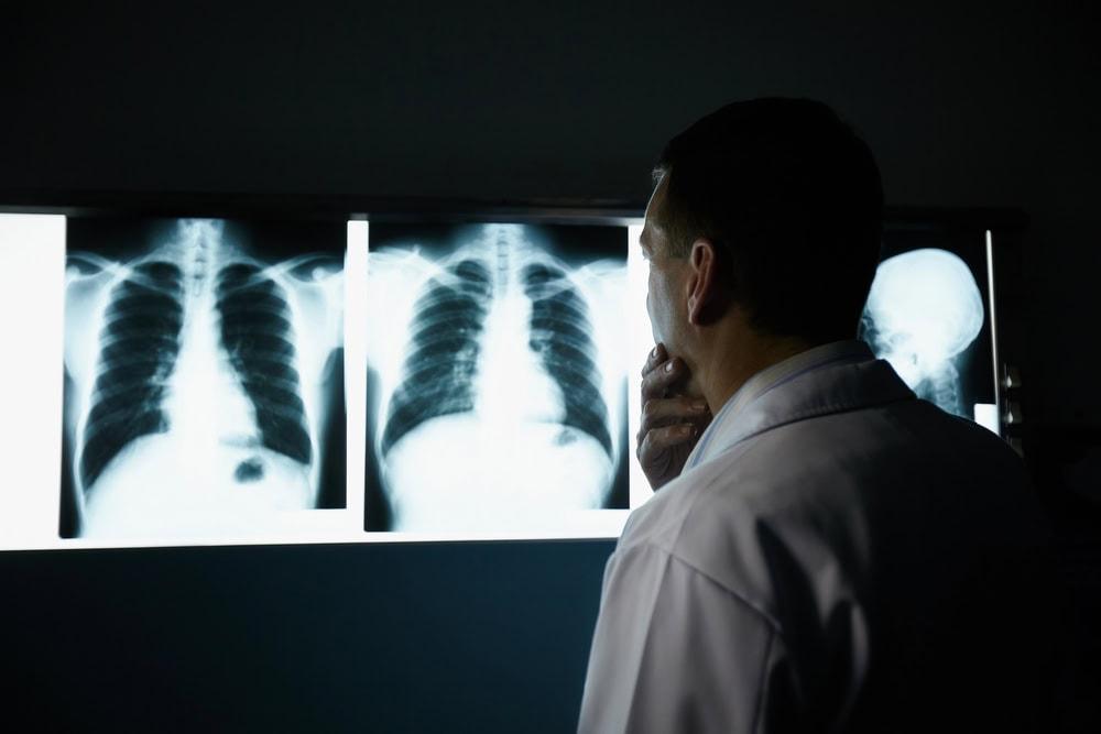 Rockford radiology malpractice lawyer representing medical negligence victims.