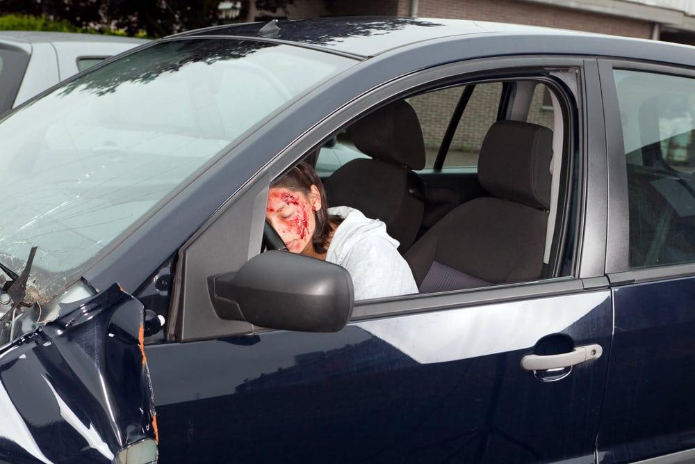 Attorney reviewing medical records for car accident face injuries involving fractured facial bones.