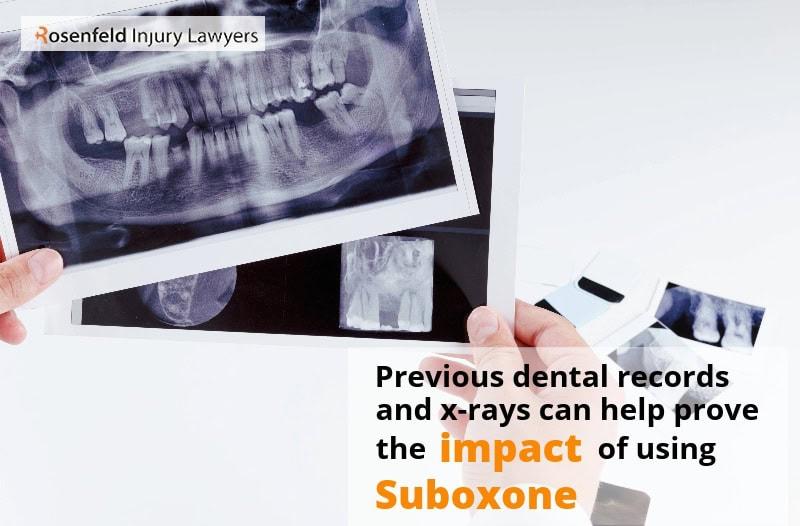Previous dental records and x-rays can help prove the impact of usinf Suboxone