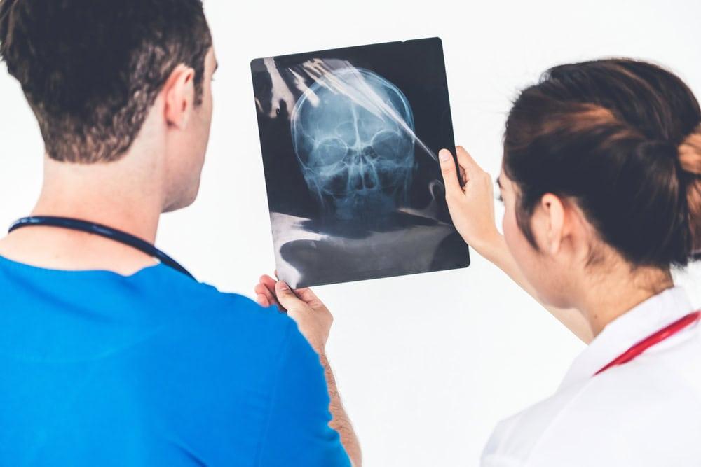 Traumatic brain injuries caused by a bicycle accident in Buffalo Grove, IL.