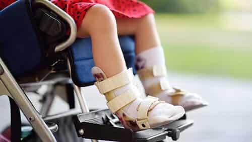 Cerebral Palsy Statistics
