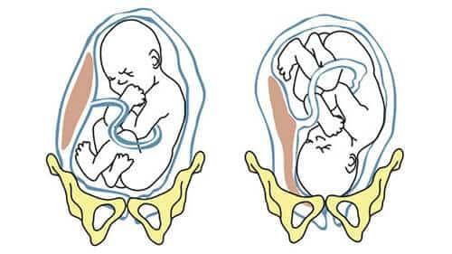 Developing Fetus Alternate Presentation