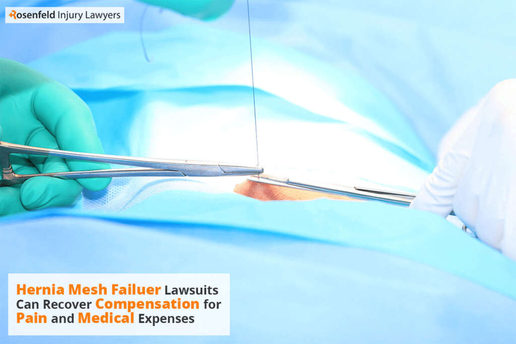 damage compensation is awarded in hernia mesh claims