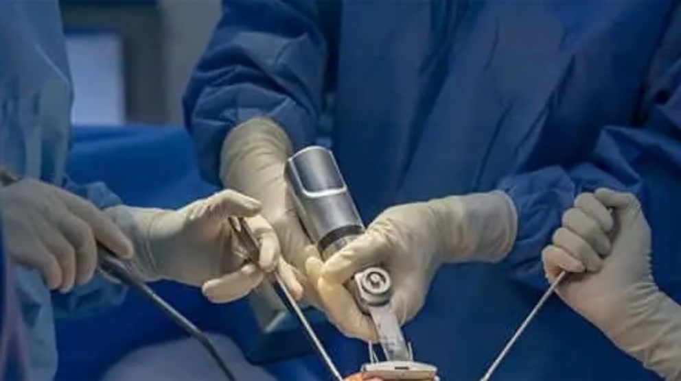 Exactech knee replacement lawsuit