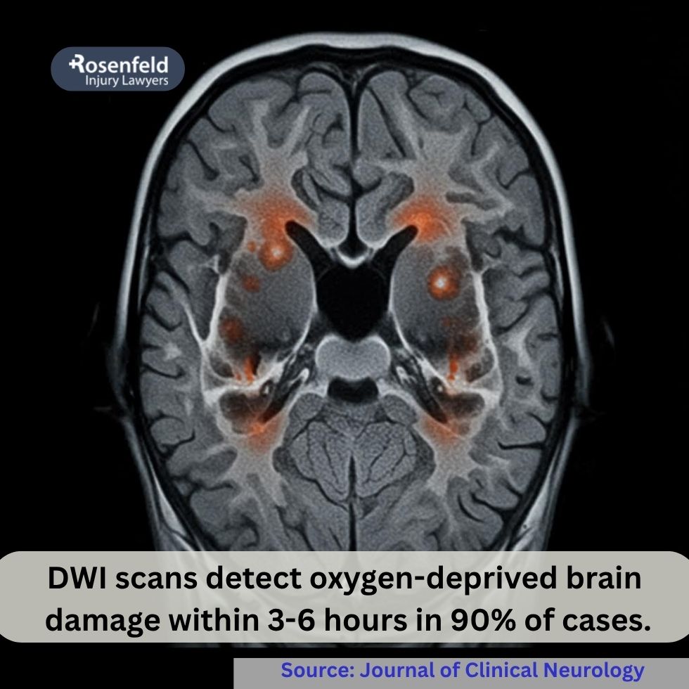 Scan of a brain injury showing damage due to lack of oxygen